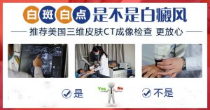診斷白癜風(fēng)所需的費(fèi)用