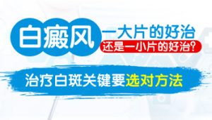 中老年人得白癜風(fēng)怎么辦?
