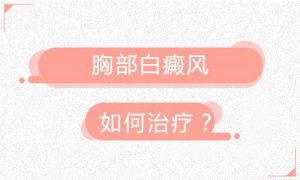 如何治療胸部白癜風(fēng)?