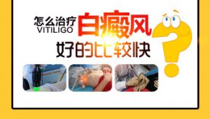 中老年人得白癜風(fēng)怎么辦?