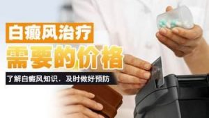 如何治療白癜風更省錢?