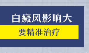 如何治療青少年白癜風(fēng)?