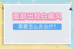 臉上長白癜風(fēng)怎么治療?