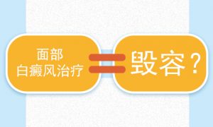 臉上長白癜風(fēng)怎么治療?