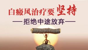 如何治療女性白癜風(fēng)?