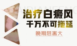 腹部白癜風(fēng)有什么危害嗎?