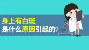 女性患白癜風(fēng)的原因是什么?