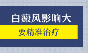 如何治療雙腳白癜風(fēng)?