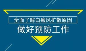 兒童應(yīng)如何預(yù)防白癜風(fēng)?