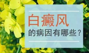 成人患白癜風(fēng)的原因是什么?