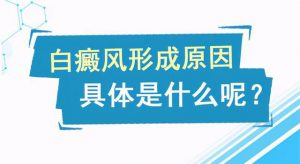 導(dǎo)致白癜風(fēng)的致病因素有哪些?