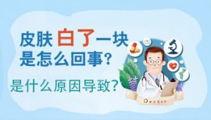 頭部白癜風(fēng)的原因有哪些?