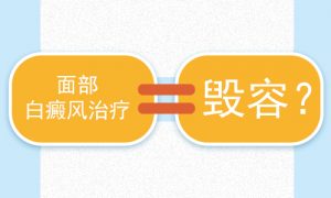 如何治療臉上的白癜風(fēng)可以變小?