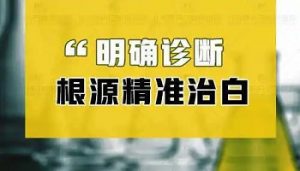 額頭上的白癜風(fēng)應(yīng)該如何治療