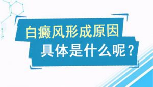 會導(dǎo)致白癜風(fēng)的原因是什么呢