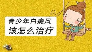 青少年白點癲風該如何治療