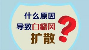 白點癲風發(fā)生擴散是什么原因?qū)е? width=